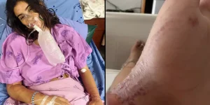 Woman issued major warning after being stung by ‘most venomous creature on earth’ that left ‘body vibrating’