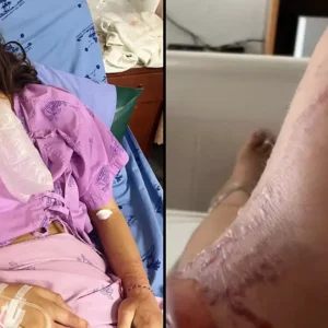 Woman issued major warning after being stung by ‘most venomous creature on earth’ that left ‘body vibrating’