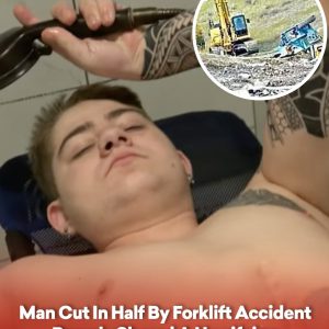 Man Cut In Half By Forklift Accident Bravely Shared A Horrifying Photo From The Scene