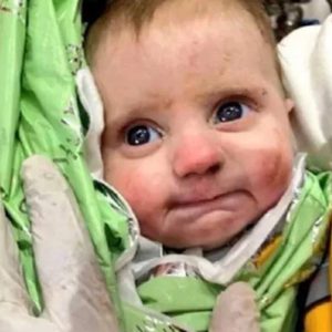 A 2-month-old baby with tearful blue eyes is miraculously rescued from under the rubble after 128 hours of unspeakable suffering—cold, hungry, and alone. This Is How Hope and Survival Look. Check out the Video in the Comment…